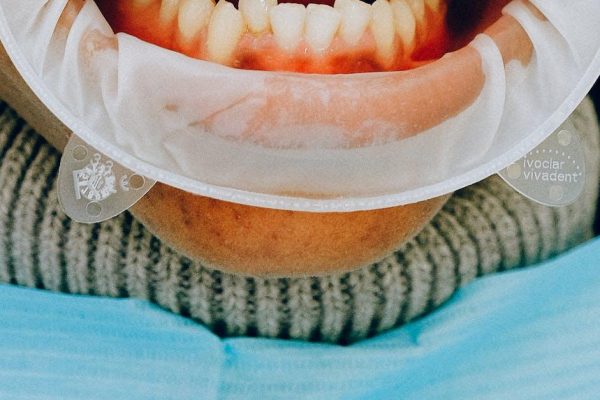 Den ultimative guide til pleje af dine tænder